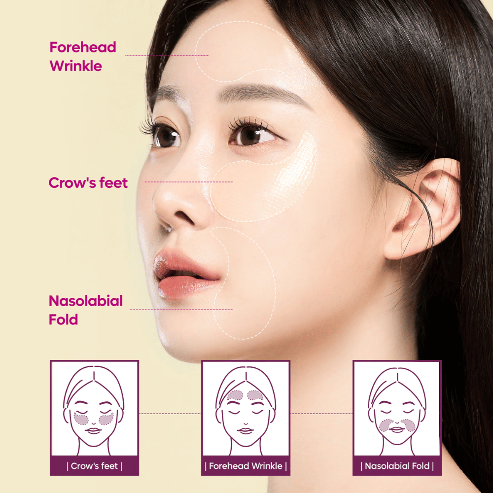 Modèle avec des patchs pour les yeux placés sur les pattes d'oie, le front et les lignes nasolabiales montrant comment Dr. Melaxin Cemenrete Calcium Volume Eye Patch peut être utilisé pour les rides et la perte de volume.