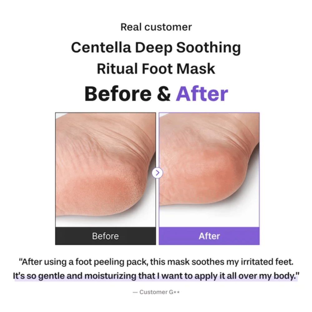6. Baren Centella Deep Soothing Ritual Foot Mask – image avant/après montrant un talon plus doux et mieux hydraté après utilisation
