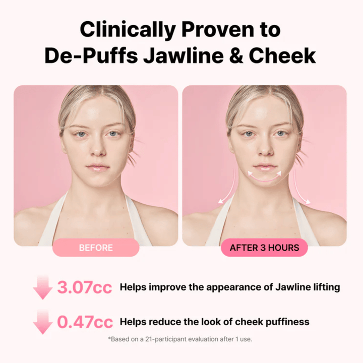 Image avant/après illustrant l’amélioration de l’apparence de la mâchoire et la réduction du gonflement après l’utilisation de RETURNITY Ear Therapy Acupressure Patch pendant trois heures.