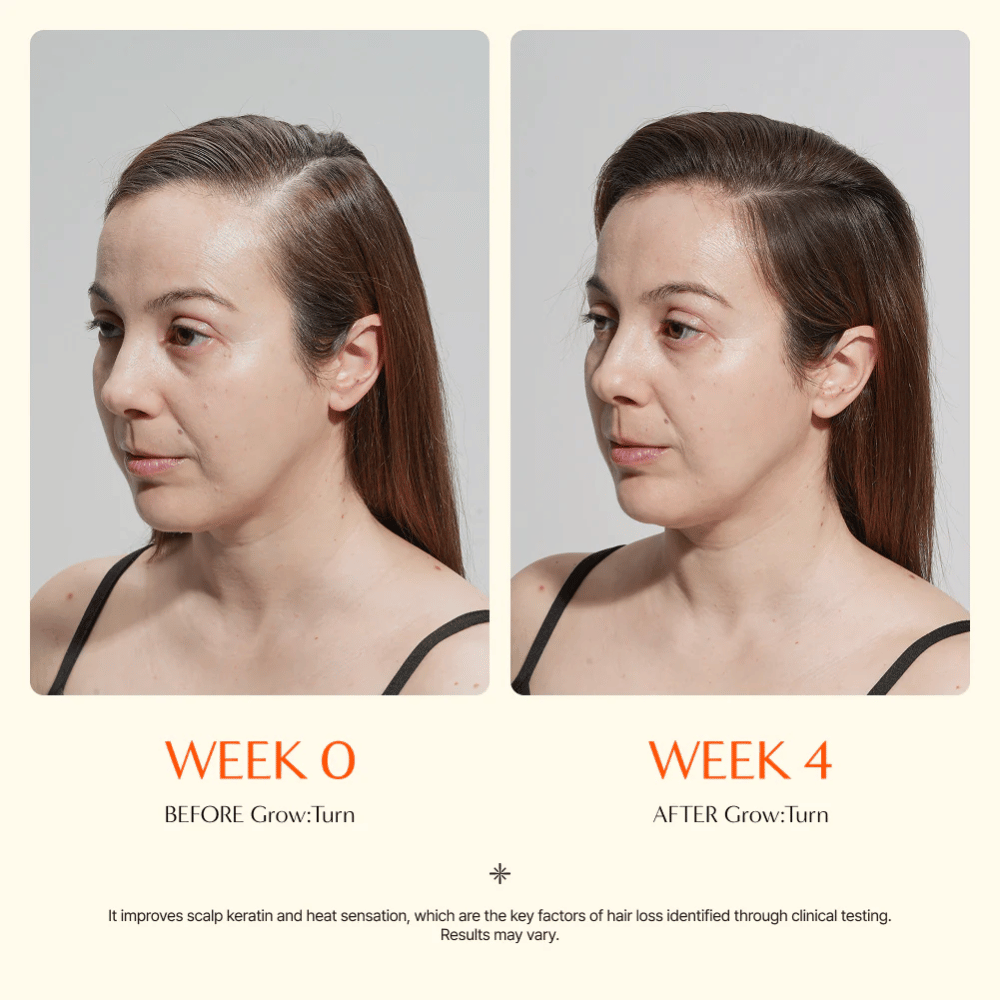Image avant/après d’une femme (semaine 0 vs semaine 4) montrant une amélioration de la qualité des cheveux et une sensation de plus grande densité après utilisation.