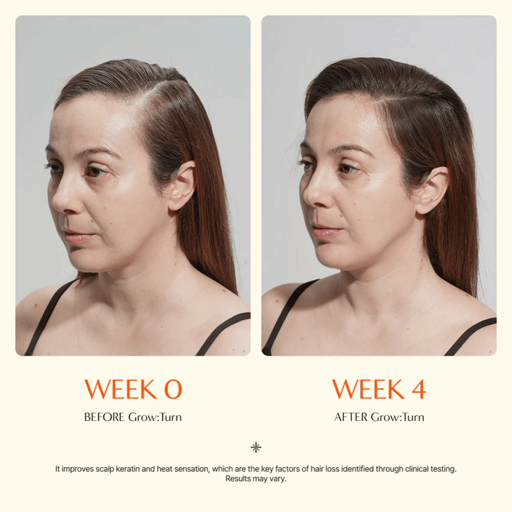 Image avant/après d’une femme (semaine 0 vs semaine 4) montrant une amélioration de la qualité des cheveux et une sensation de plus grande densité après utilisation.