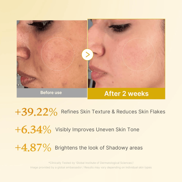 Image avant/après pour Medicube Kojic Acid Turmeric Resurfacing Toner montrant une texture de peau améliorée, un teint plus uniforme et une réduction des squames sèches après deux semaines d’utilisation.