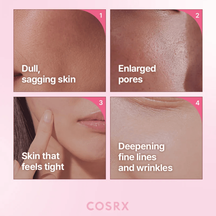 Image informative mettant en avant des problèmes de peau courants tels que le teint terne, les pores dilatés, la peau tiraillée et les ridules.