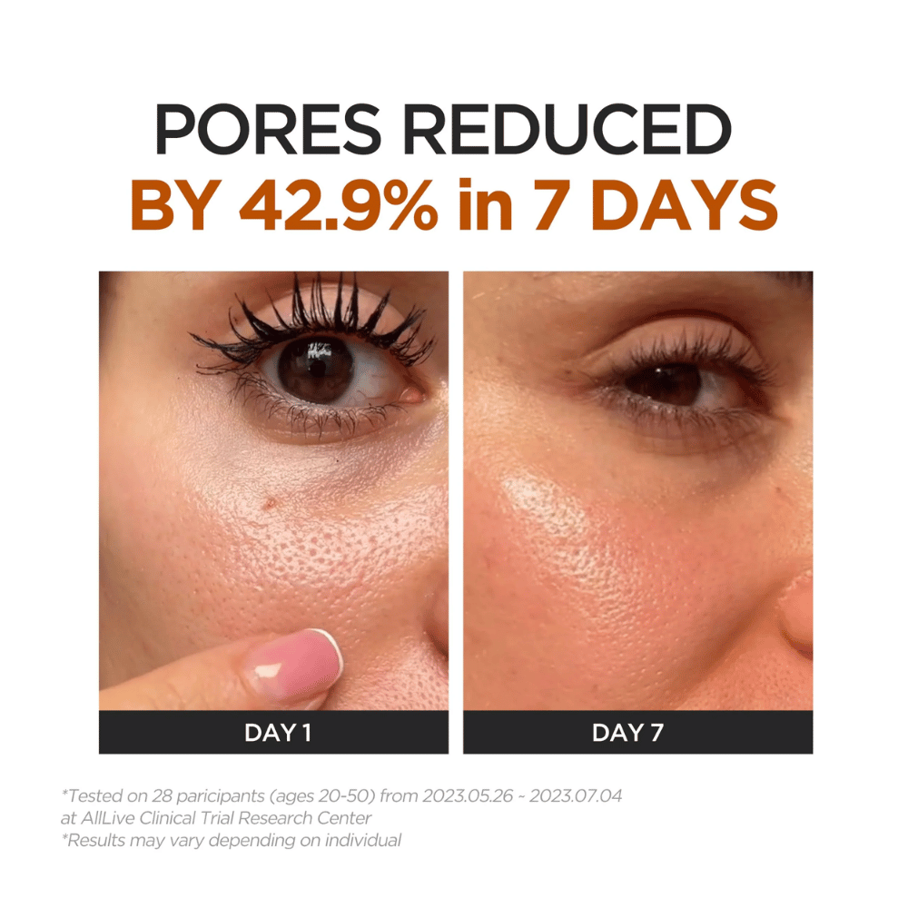 Image avant/après montrant des pores visiblement réduits après sept jours d’utilisation. Des gros plans de la peau illustrent une texture cutanée plus uniforme et plus lisse entre le jour 1 et le jour 7.